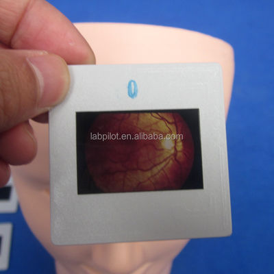 Manikine pour l'examen avancé de l'œil humain Simulateur de formation Rétinopathie Fondus modèle