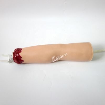 Modèle de soins infirmiers traumatisants Amputation du bras et hémostase pour le traitement des plaies des membres supérieurs
