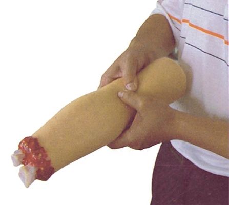 Science médicale Simulateur de soins de traumatisme Modèle de sang et de bras amputé
