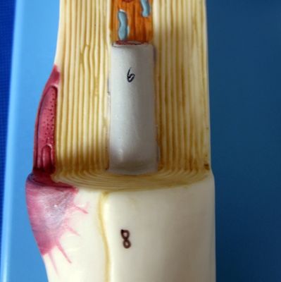 Modèle anatomique avancé en PVC du corps de cellules neuronales agrandie et de la structure des fibres nerveuses