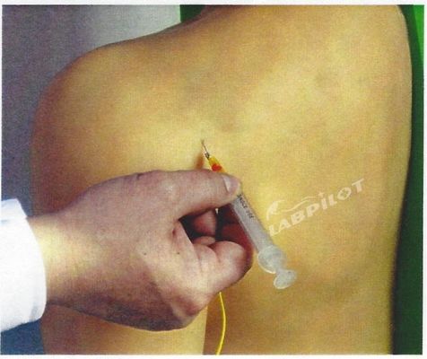 Sujet Science médicale Manikine électronique de l'épaule Simulateur d'entraînement de l'injection de l'articulation Modèle infirmier