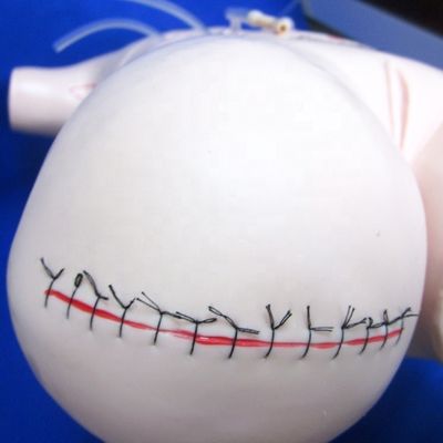Modèle réaliste d'enseignement de l'appendicectomie pour les compétences de pansement et de suture