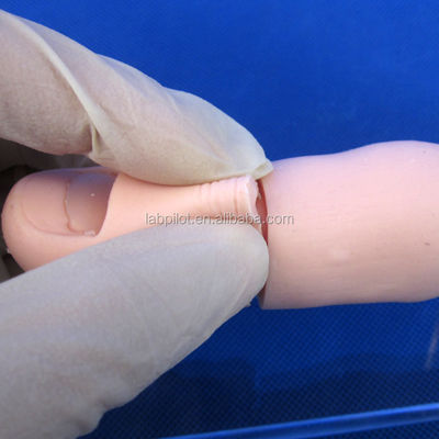 Modèle de formation à l'excision des ongles pour l'enseignement des compétences en chirurgie clinique en sciences médicales