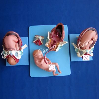 Modèle de démonstration anatomique médicale de l'accouchement Pelvis et modèle fœtal à terme