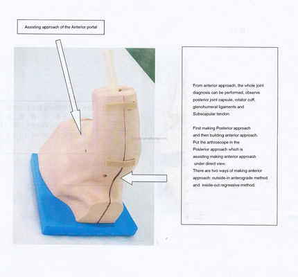 Modèle de formation en anatomie articulaire de l'épaule avec simulateur détachable d'arthroscopie de l'épaule