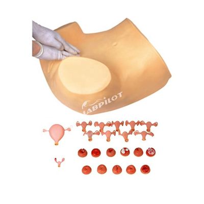 Formation aux soins de maternité avec mannequin de formation en gynécologie