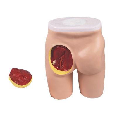 Modèle d'enseignement complet de l'injection IM pour l'éducation aux muscles du gluteal et à l'anatomie