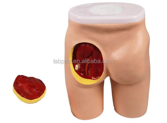 Modèle d'enseignement complet de l'injection IM pour l'éducation aux muscles du gluteal et à l'anatomie