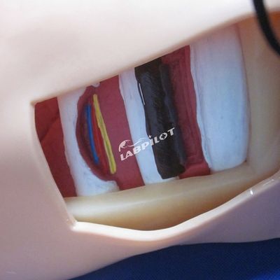 Manikine de décompression du pneumothorax en PVC pour une simulation artificielle de l'hydrothorax
