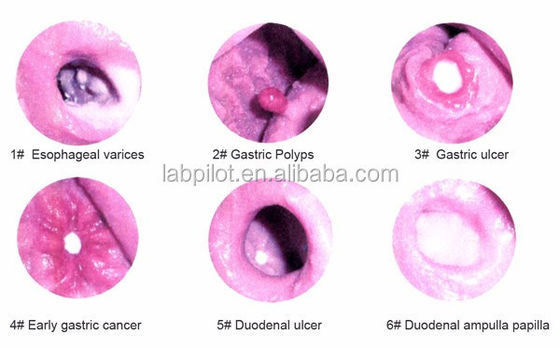 Gastroscope de taille humaine Duodénoscope et ERCP pour l'enseignement de l'anatomie gastro-intestinale
