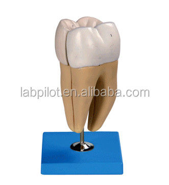 Structures anatomiques détaillées des dents molaires inférieures adultes Modèle de soins dentaires avancés en PVC