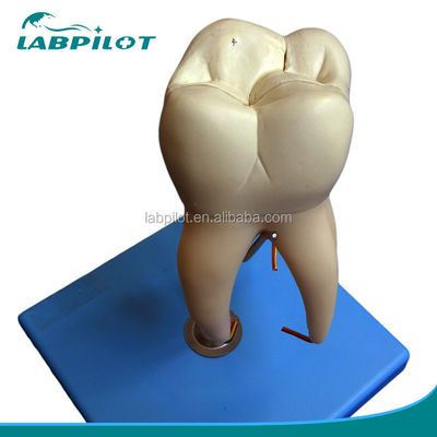 Dentiste démonstration de soins Détachable modèle anatomique des dents pour les dents molaires à trois racines
