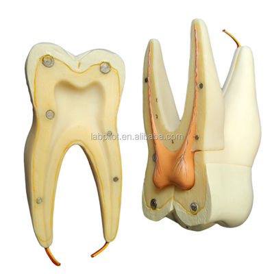Dentiste démonstration de soins Détachable modèle anatomique des dents pour les dents molaires à trois racines