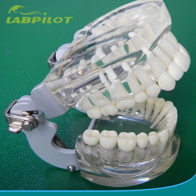 Modèles de formation en dentisterie adultes standard transparents Colonne dentaire modèle taille standard