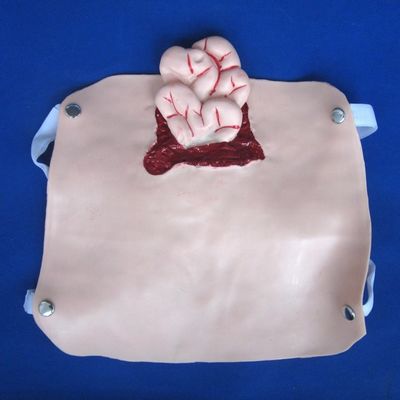 Modèles avancés de traumatismes en PVC pour la formation en soins infirmiers et la démonstration des soins aux patients