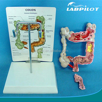 Modèles anatomiques ophtalmologiques Modèle intestinal humain pour les maladies du côlon et du rectum