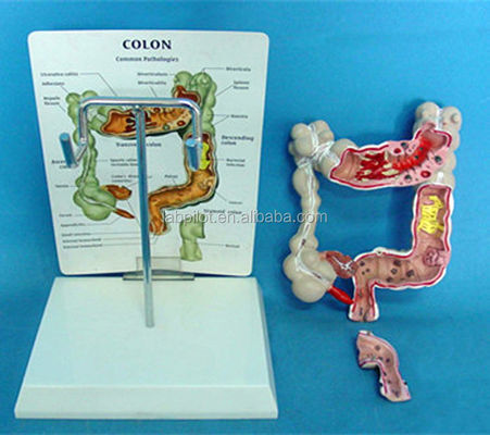 Modèles anatomiques ophtalmologiques Modèle intestinal humain pour les maladies du côlon et du rectum