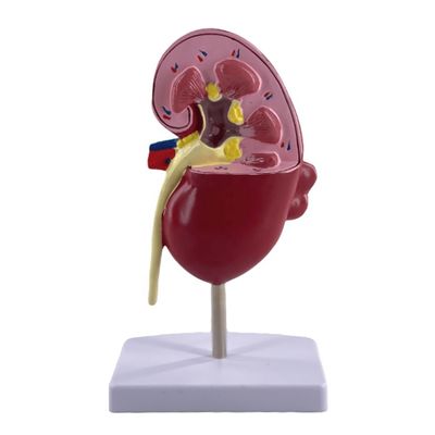Modèle de rein pathologique en PVC pour les écoles de médecine et les hôpitaux d'urologie
