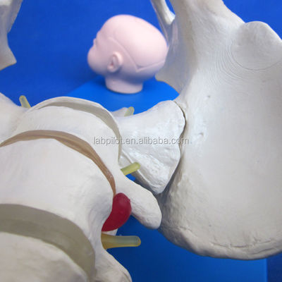 Vivant pelvis et têtes fœtales Modèle PVC avancé pour la démonstration des compétences d'accouchement