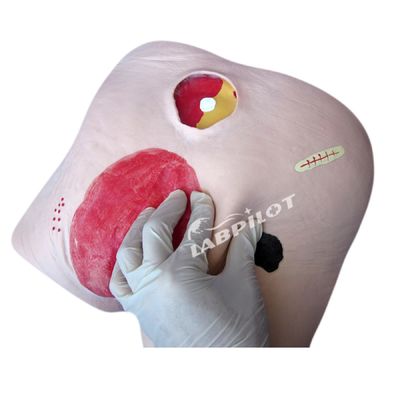 Simulateur de formation en soins des ulcères pour les catégories en sciences médicales