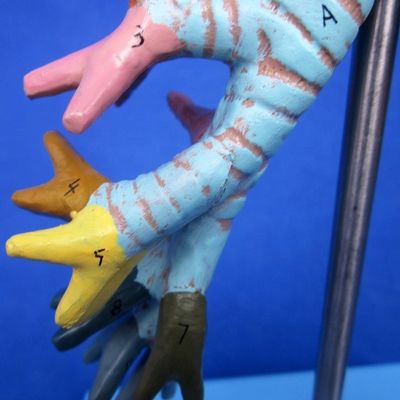 Science médicale affiche détachable bronchique Arbre et modèle de trachée pour l'anatomie du larynx