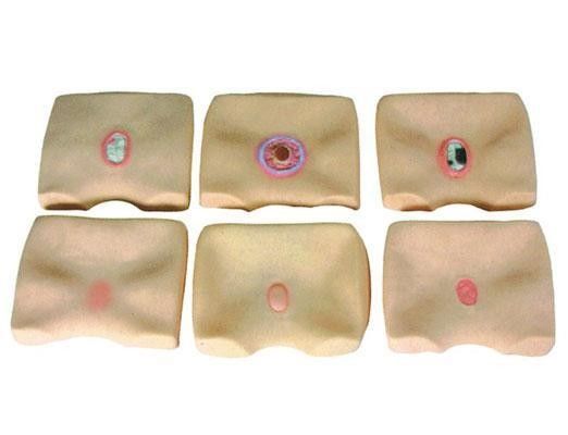 Simulateur d'ulcères pour les hôpitaux améliorer la formation en soins infirmiers