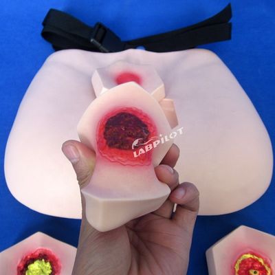 Modèle de soins aux patients Modèle d'enseignement des plaies de lit