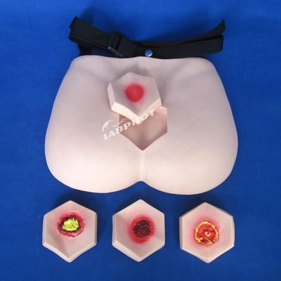 Modèle de soins aux patients Modèle d'enseignement des plaies de lit