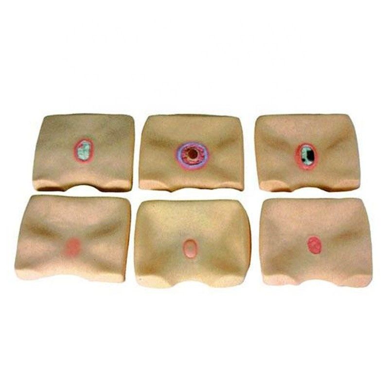 Simulateur d'ulcères pour les hôpitaux améliorer la formation en soins infirmiers